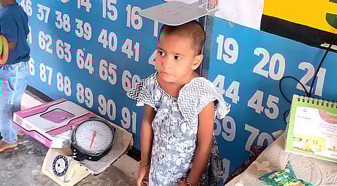 Malnutrition rampant in Uttarakhand, Almora hit worst