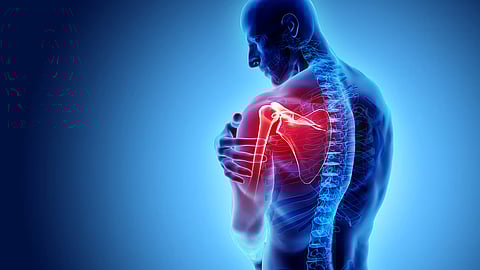 Could a past bone break lead to Arthritis in later life?