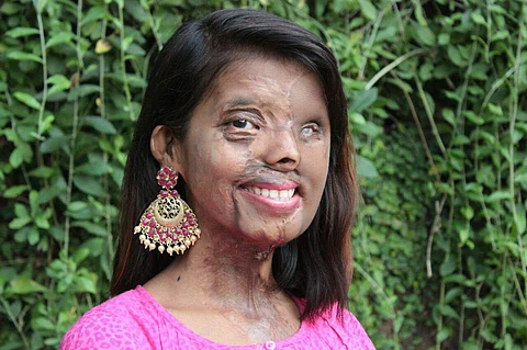 Anmol runs the NGO Acid Attack Survivors Saahas
