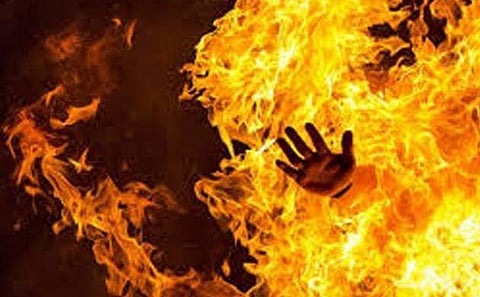 The authorities rushed to the classroom and broke the door open finding Pateriya more than half burnt