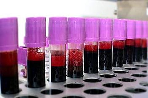 Dhoondh does it's best to those who need plasma therapy | (Pic: Internet)