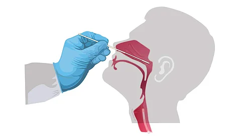 Nasal swab | Pic: cdc.gov