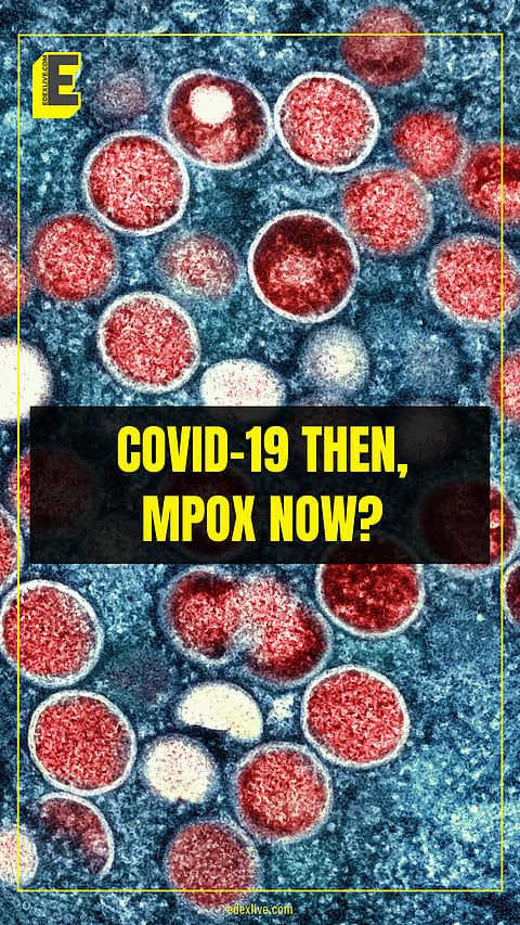 Should India be worried about a mpox outbreak?