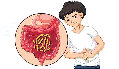 Representative Image