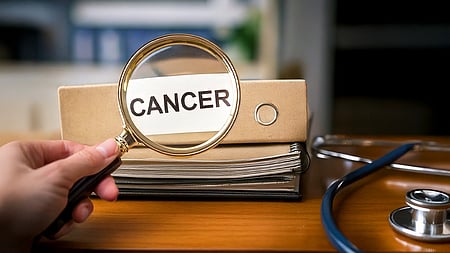 Colon Stiffness Linked to Higher Early-Onset Colorectal Cancer Risk