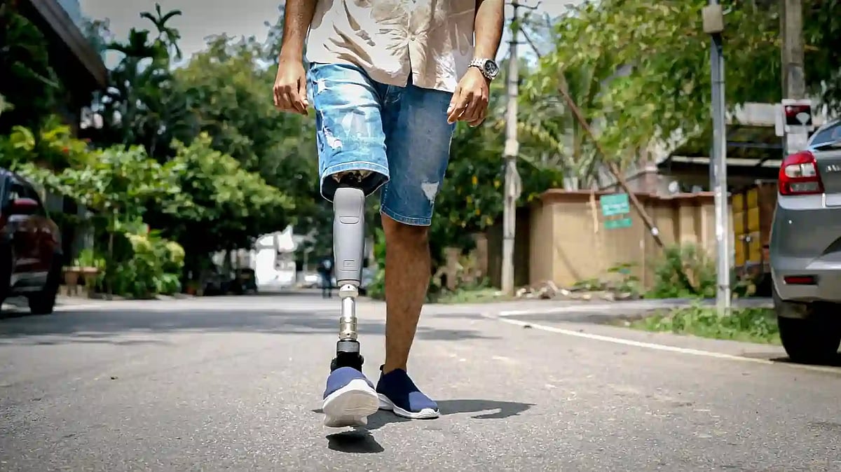 Around 300 beneficiaries to receive prosthetic limbs in Thane camp