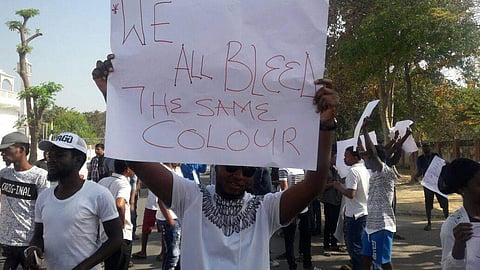 Bleed black and blue? | Facebook