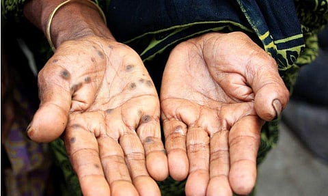 The e IISER official said, 83 blocks in eight districts of West Bengal are hit by  arsenic contamination