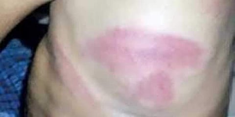 The five students were beaten with PVC pipes. The students had alleged that the hostel warden was sneaking into their rooms and stealing money while they were attending classes