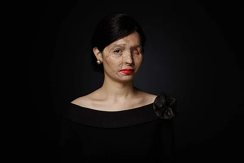 Reshma Qureshi (Pic: Make Love Not Scars)