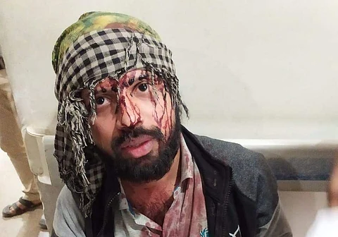 Sandip Luis, one of the protestors injured at the protest on Monday (Pic: JNUSU)