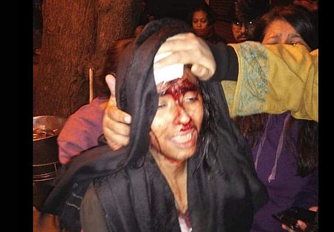 Aishe after the attack