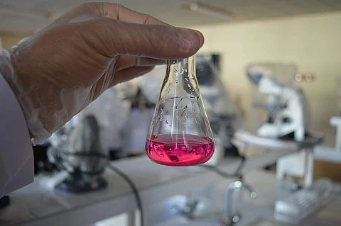 Representational image (Pic: Pxfuel)