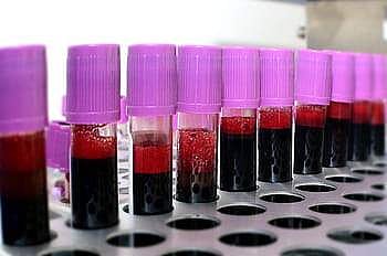 Dhoondh does it's best to those who need plasma therapy | (Pic: Internet)