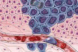 Representative Image | Pic: Wikimedia