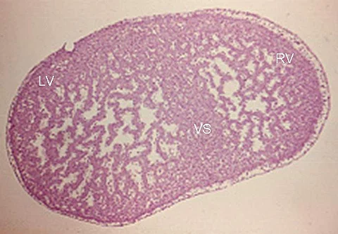 Research identifies new cause of inherited heart condition