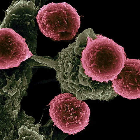 Aligarh Muslim University professor leads cancer prevention breakthrough discovery